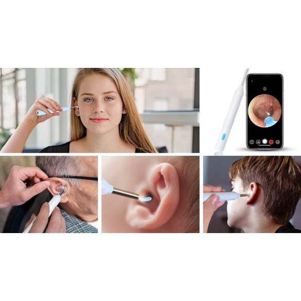 Elektromos fültisztító készlet, otoszkóp, HD mini kamerával, Wifi-s, LED világítással, Wooze Visual Ear Cleaner, fehér